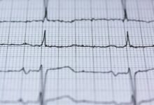 quantum pulse hyper orbit