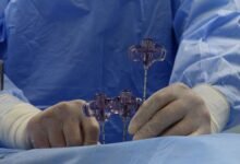 surgical tech study guide overview